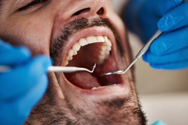 Best Urgent Tooth Repair  in Natchez, MS